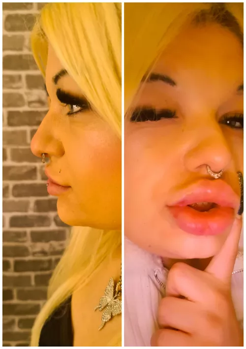 Still need more Injections for perfect DSLs 🥰 by MariellaSun