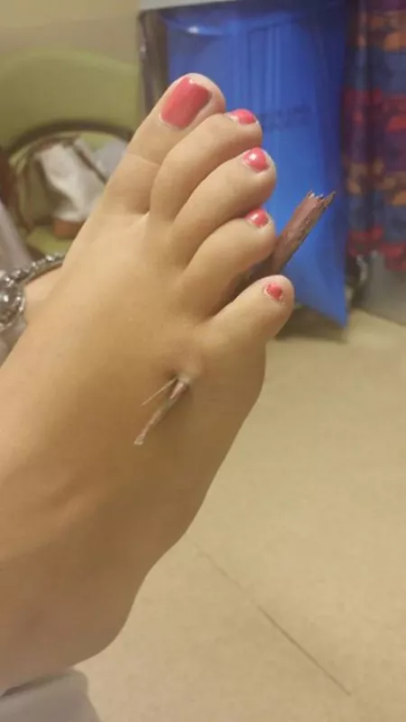 still not worse than stepping on a LEGO by spooktree