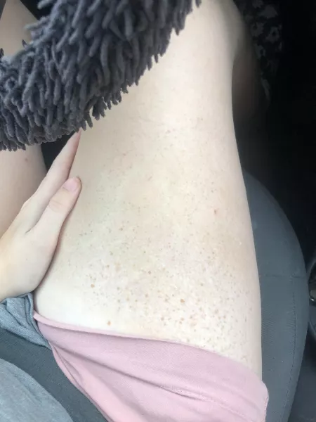 Summer freckles by twizzie22