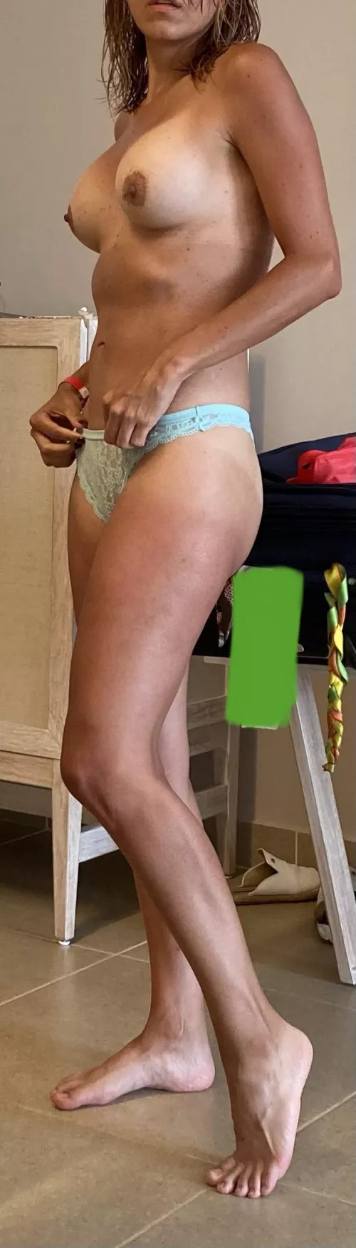 sunburn 42 female by Guestcouple