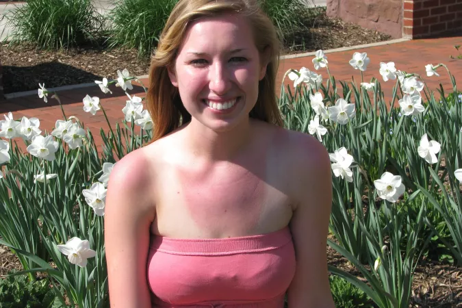 Sun-burnt lines by [deleted]