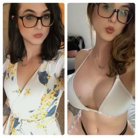 Super happy with how my boob job turned out! Lips are next 😊💋 by Dream_Skies