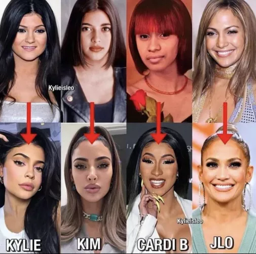 😬 surgery shouldn’t be allowed by A2F2502