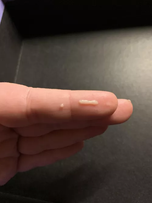 Surprise thigh pimple explosion by drizzlebopper