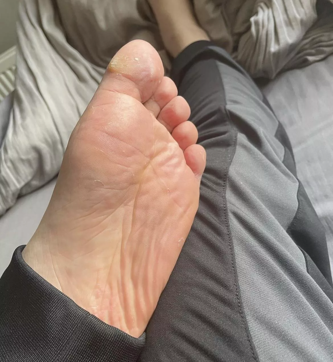 Sweaty feet after a run 🏃‍♀️ posted by Smellyfeet2021