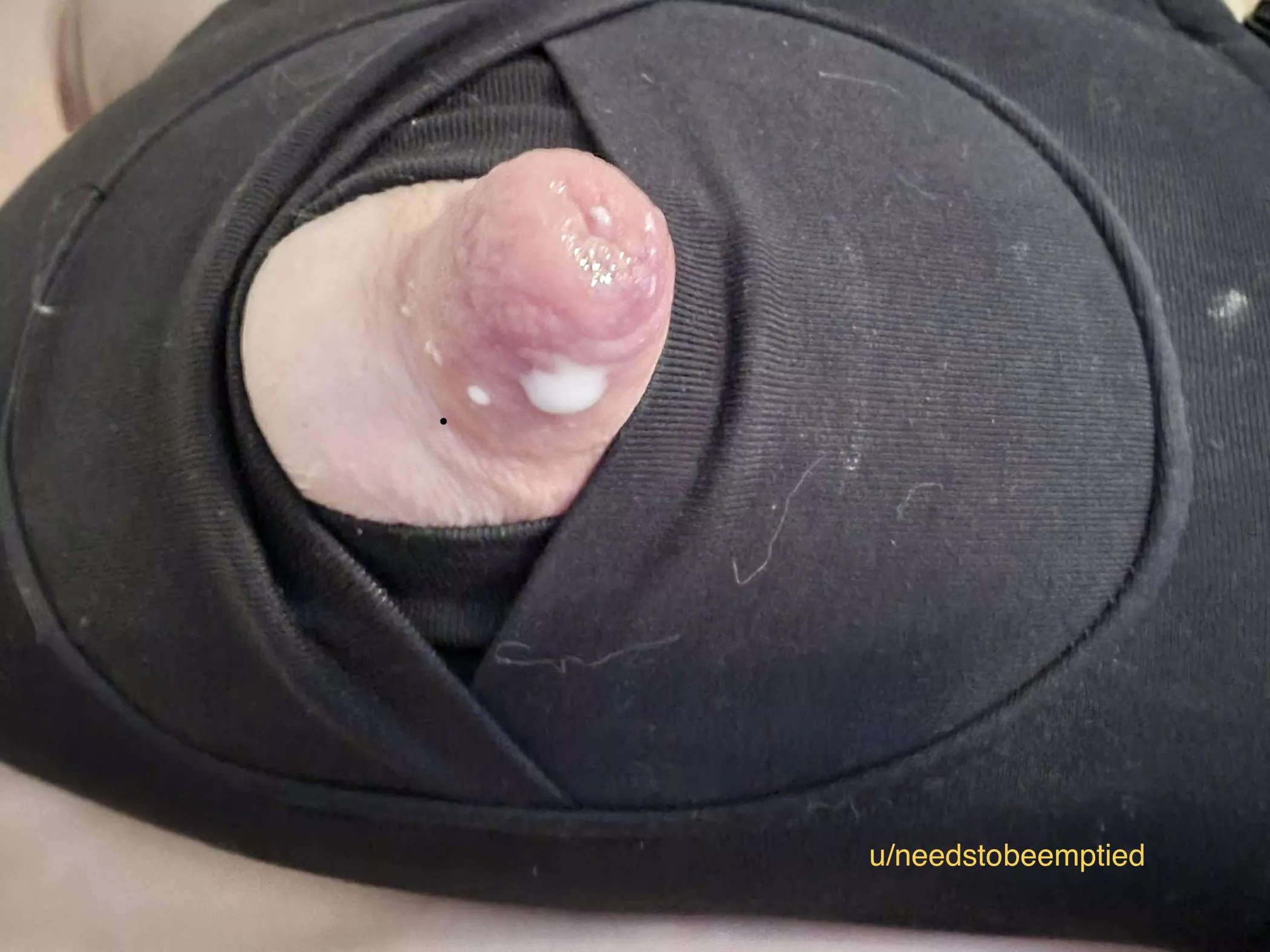 Swollen gum drop still leaking after a long pump posted by needstobeemptied