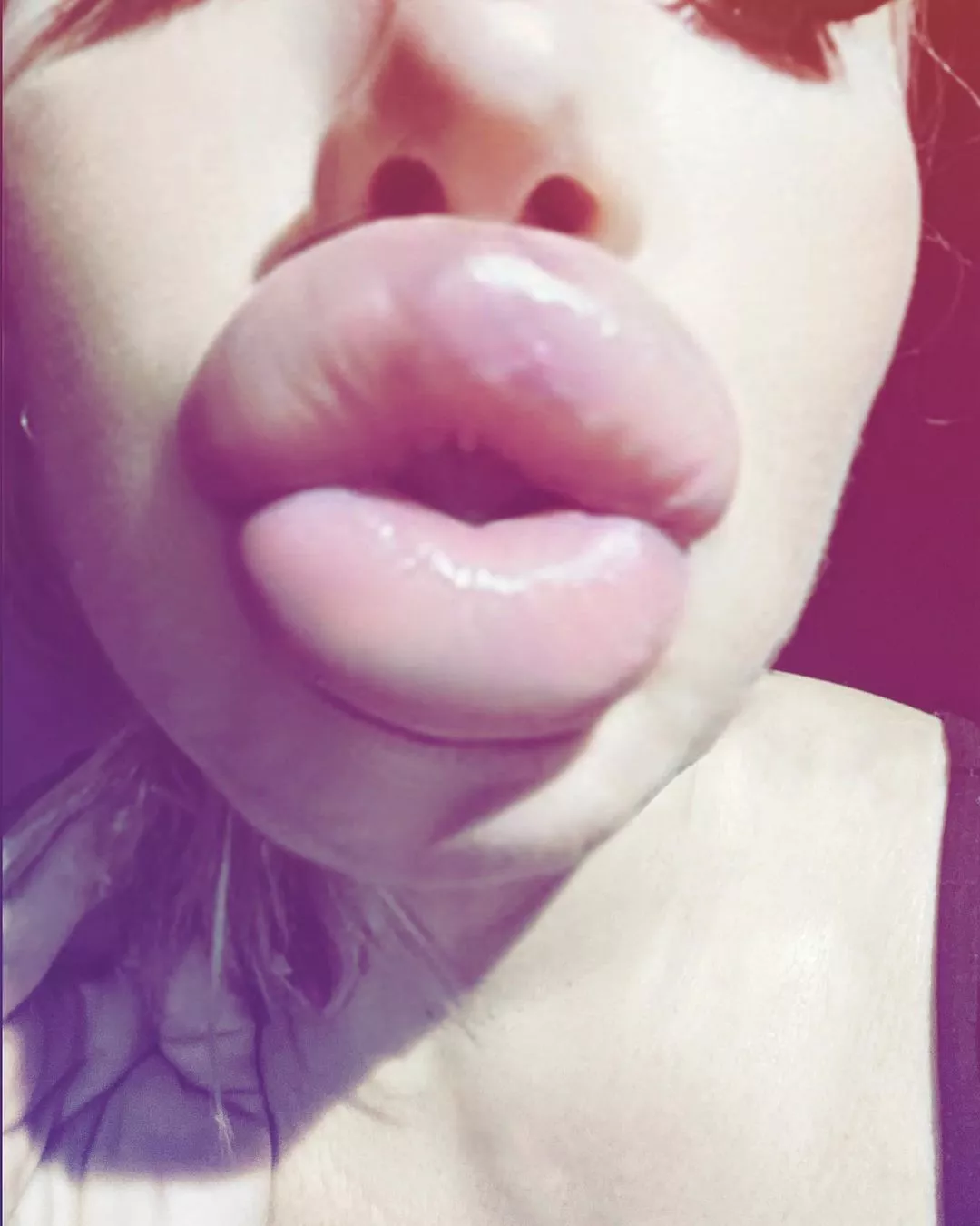 Swollen & up close posted by Marathon1981