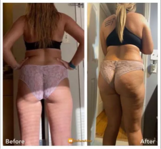 That’s one way of making an oversized pair of panties fit 😏😂 by keaton932