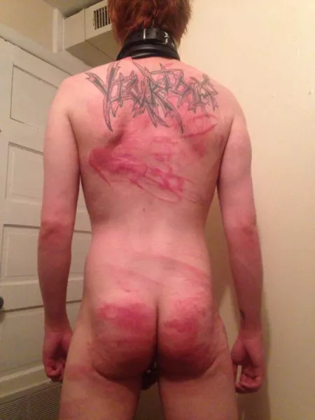 The aftermath of the hardest beating i ever got by WyattMadrox