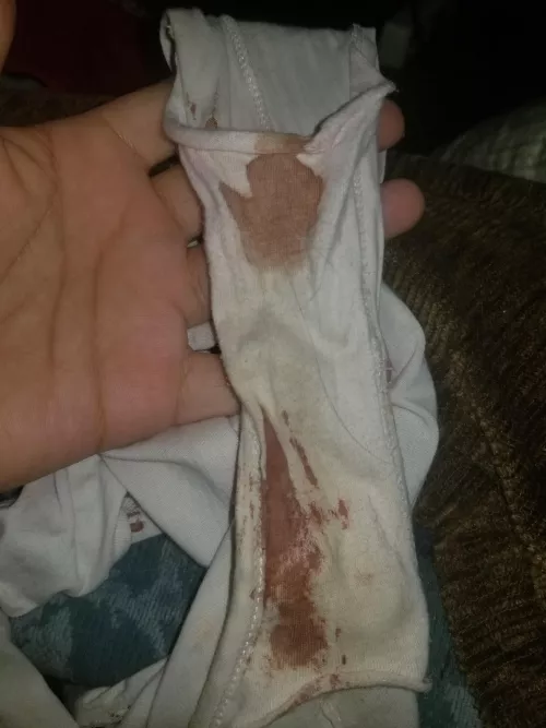 The damage by VioletsDelicacies