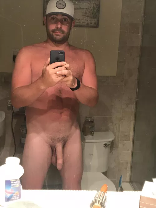 The sun attacked me. by ChemicalElectrical12