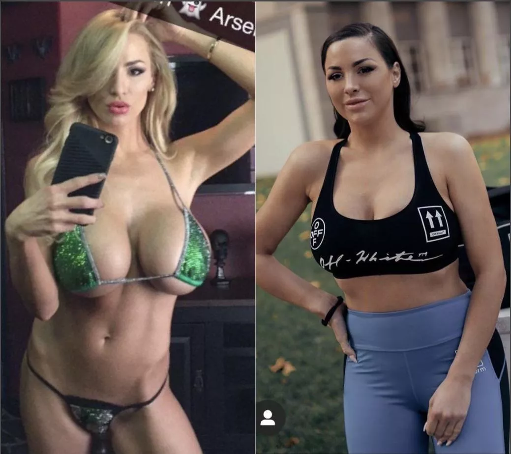 Then and now. Implants removed and face pumped full of botox. Sad. posted by Cpc4171