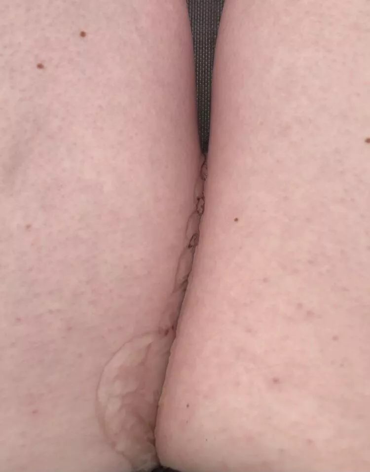 There are so many people around and I just keep soaking this chair 🥴 posted by Lucky_Bookkeeper7689