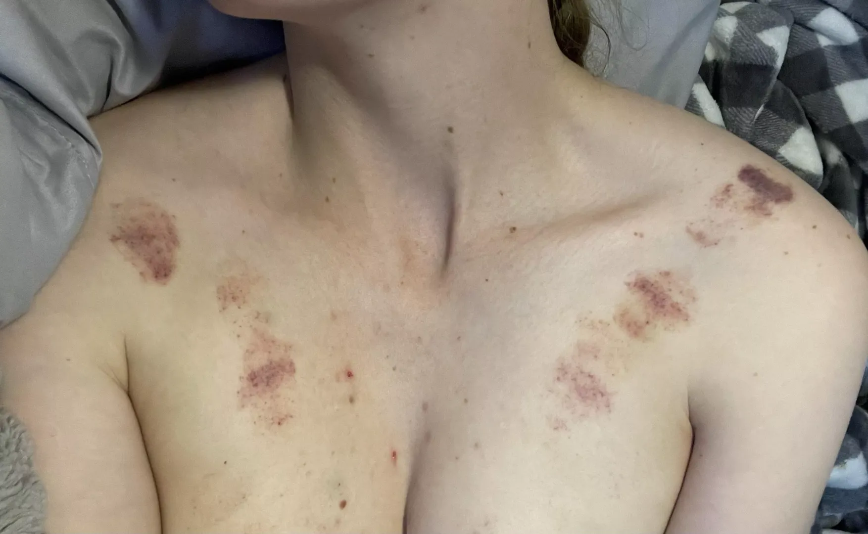 They are well decorated today posted by T_Made