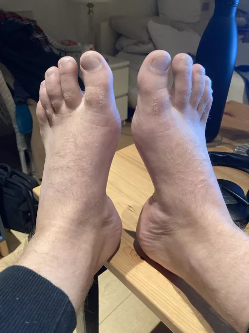 They need some attention! by bestfeetfwd04