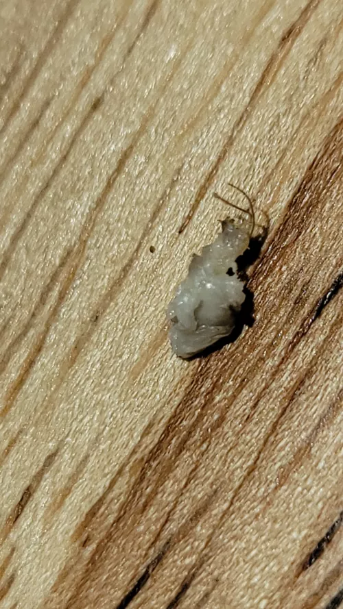 This came out while pulling out an ingrown hair by namecatjerry