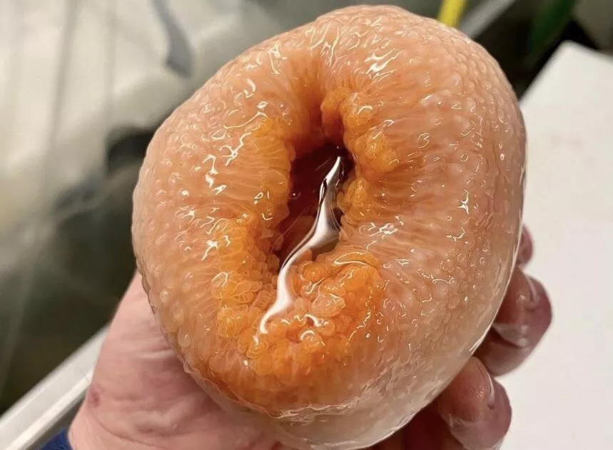 This donut posted by Tobinyo