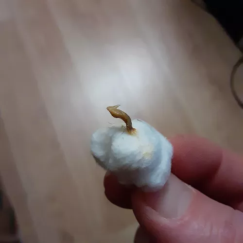 This guy was stuck in the attic of my mastoid cavity. by eulerman