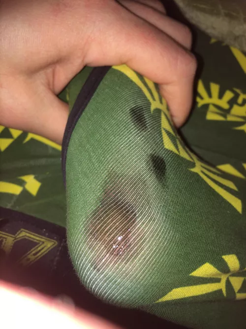 This happens if I wear the same underwear for too long by TrevLaBev