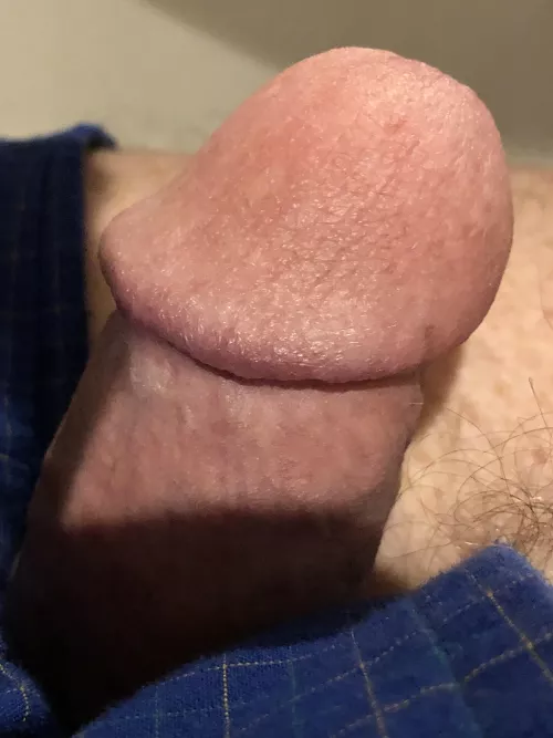 This head needs some high power suction right about now! by No_Cardiologist_2946