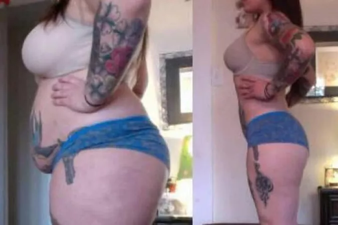 This is from a weight loss ad, but after studying it I'm convinced it's a weight gain, before and after: it's unlikely her underwear went from too tight to perfectly fitting. by wgwgwg