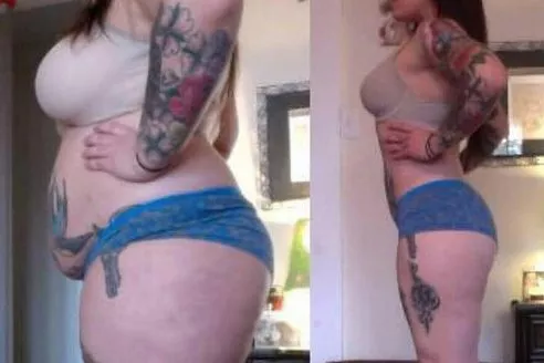 This is from a weight loss ad, but after studying it I'm convinced it's a weight gain, before and after: it's unlikely her underwear went from too tight to perfectly fitting. posted by wgwgwg