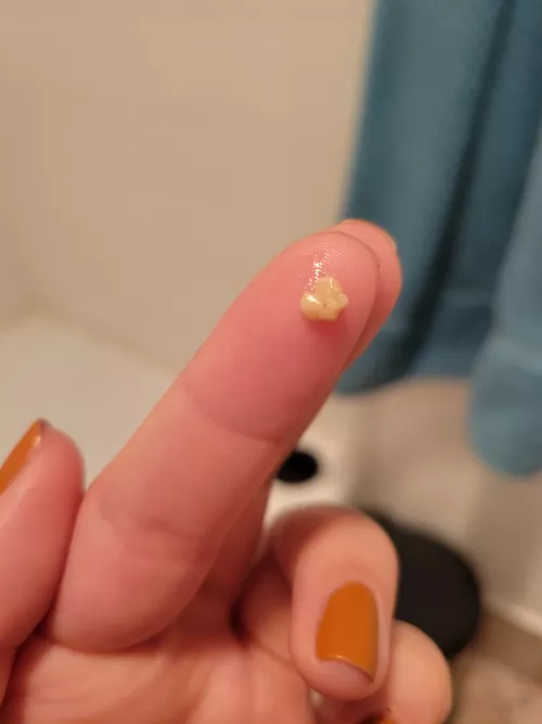 This one took almost no effort to get out. by Cassiopeia2996