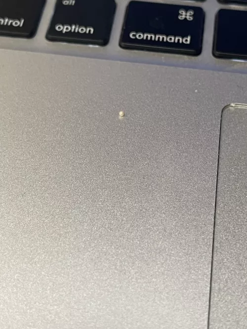 This perfect pearly milia I just dislodged from my ear canal by Librae25