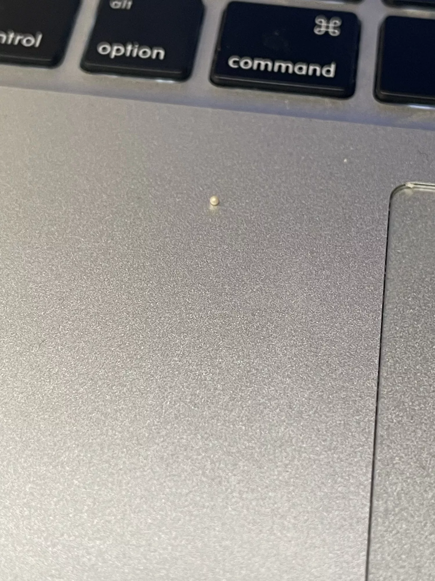 This perfect pearly milia I just dislodged from my ear canal posted by Librae25