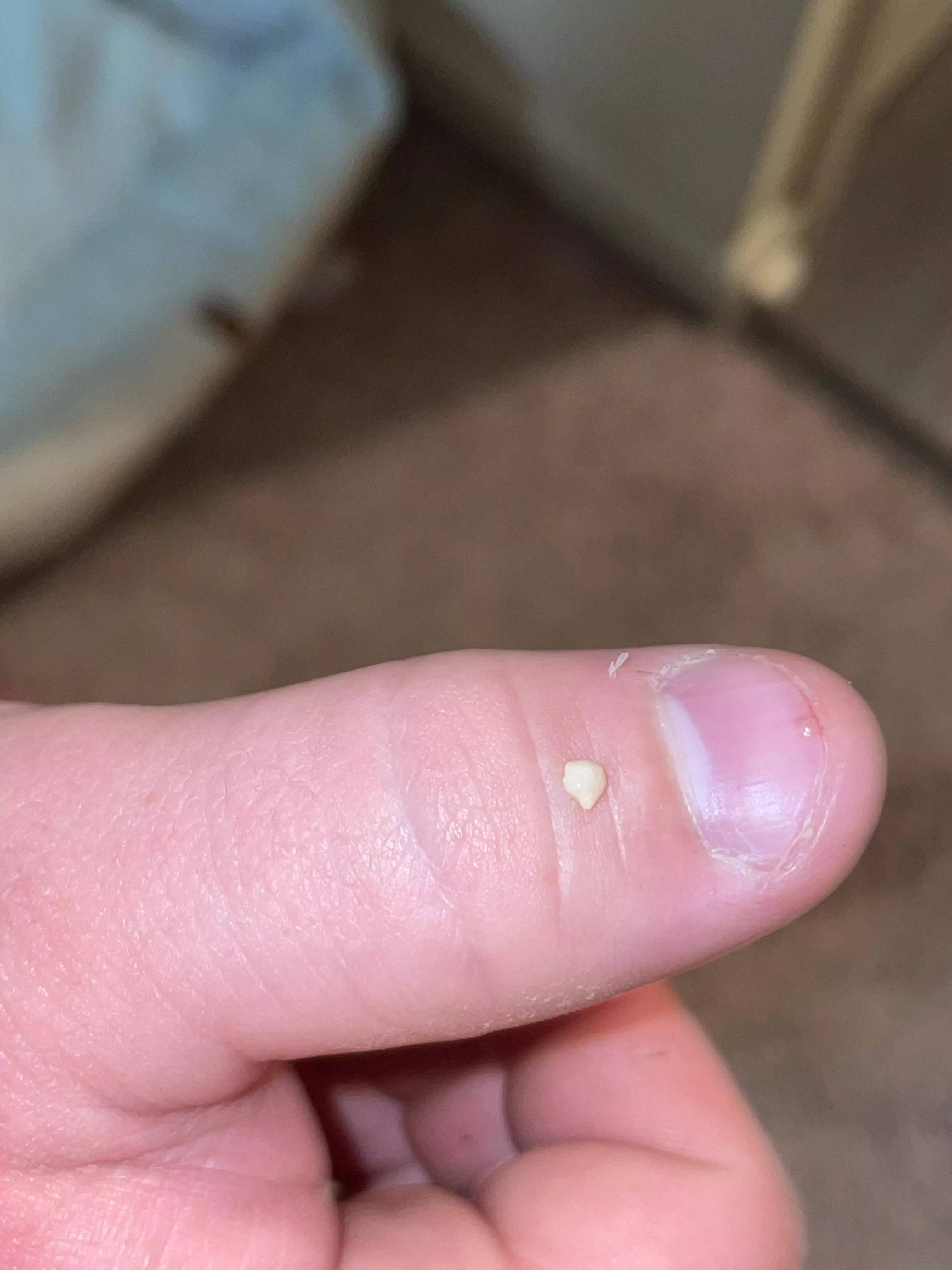This thing came out from behind my ear and there’s still more of it inside posted by Schwimmingalong