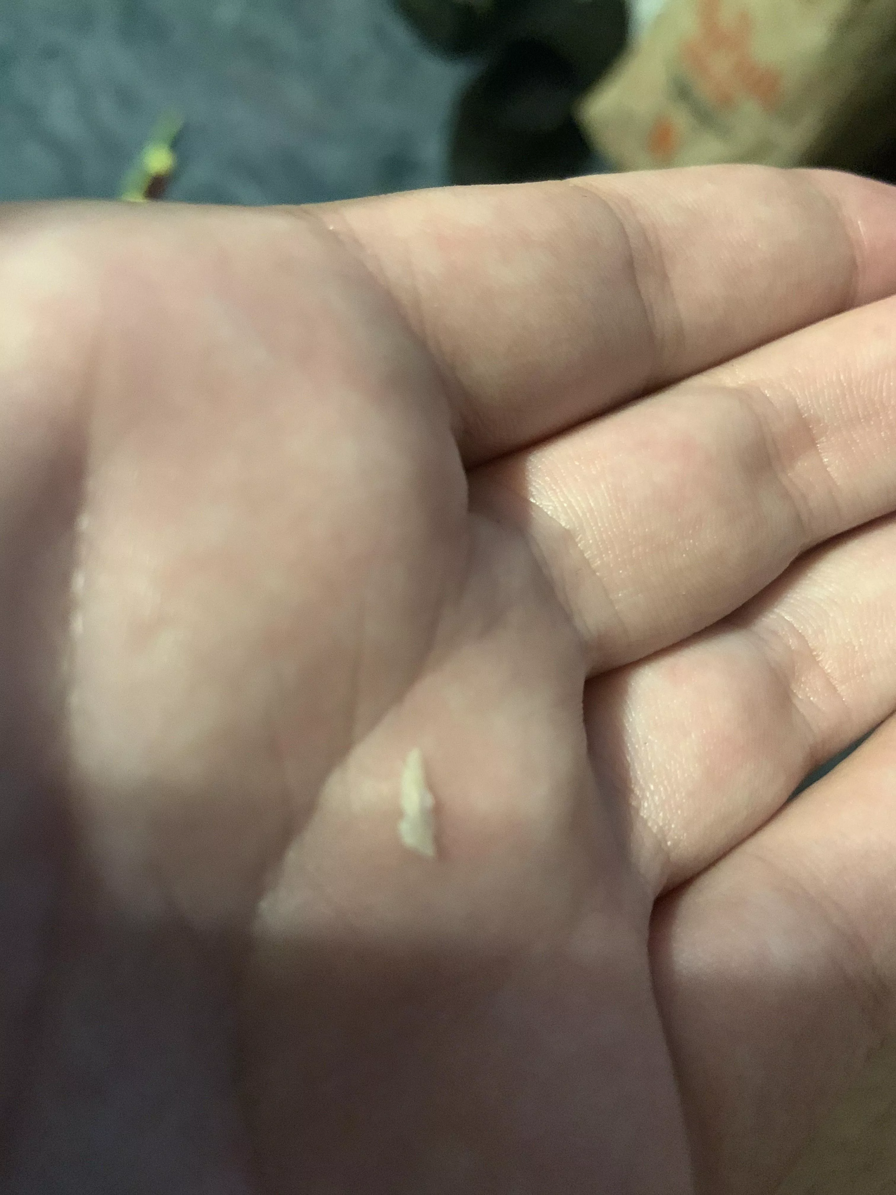 This thing popped out of the gum around one of my teeth, and now the area it came out of is bleeding like mad. posted by Arvha