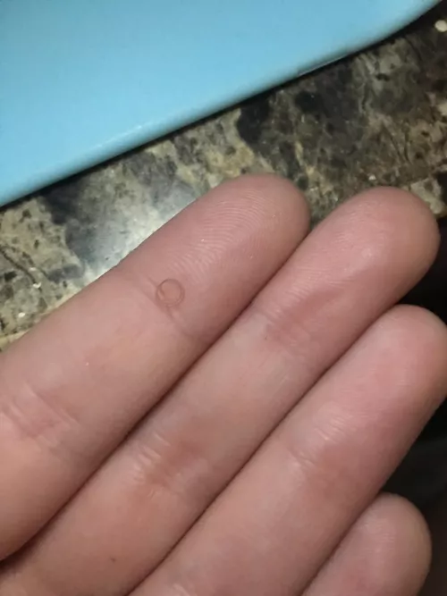 This was the ingrown hair from my pubic area. I got it out after. OC. Cont. by Routine-Key2175