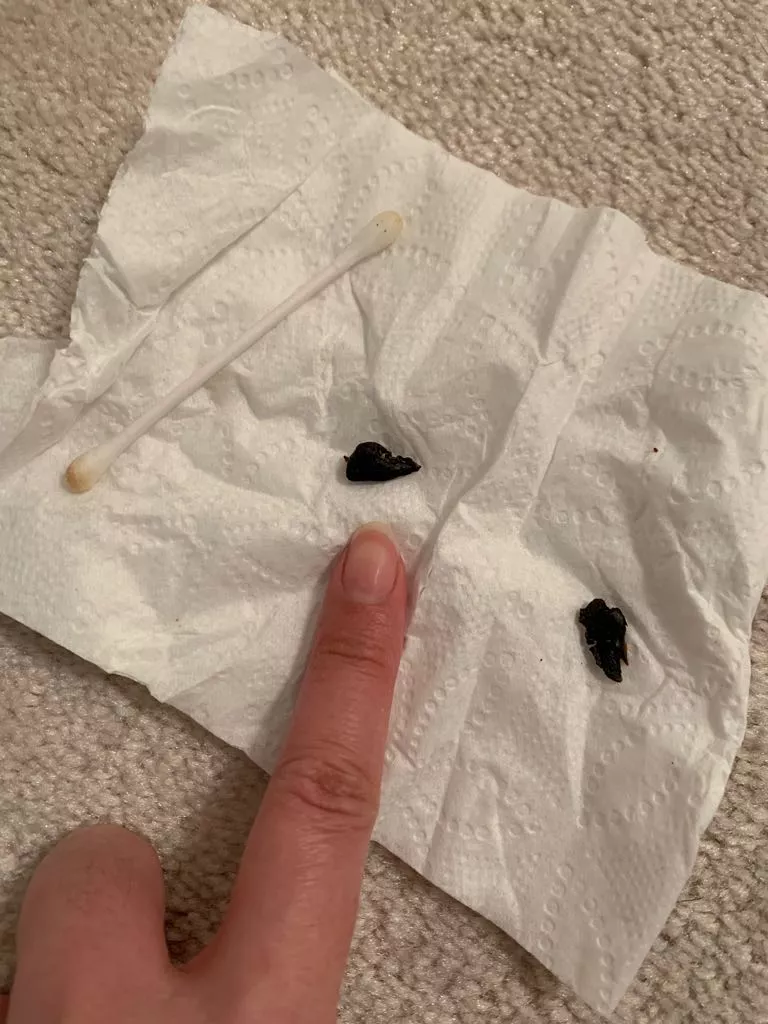 Thought my rabbit had two buttholes, turns out his scent glands were plugged posted by 3cream2sugar