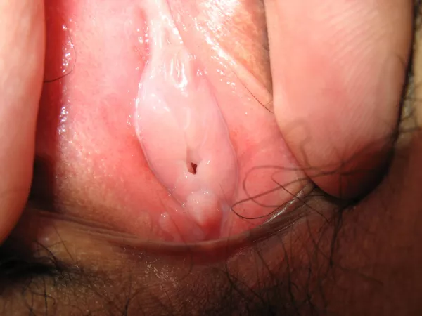 Tighter by organ_donor