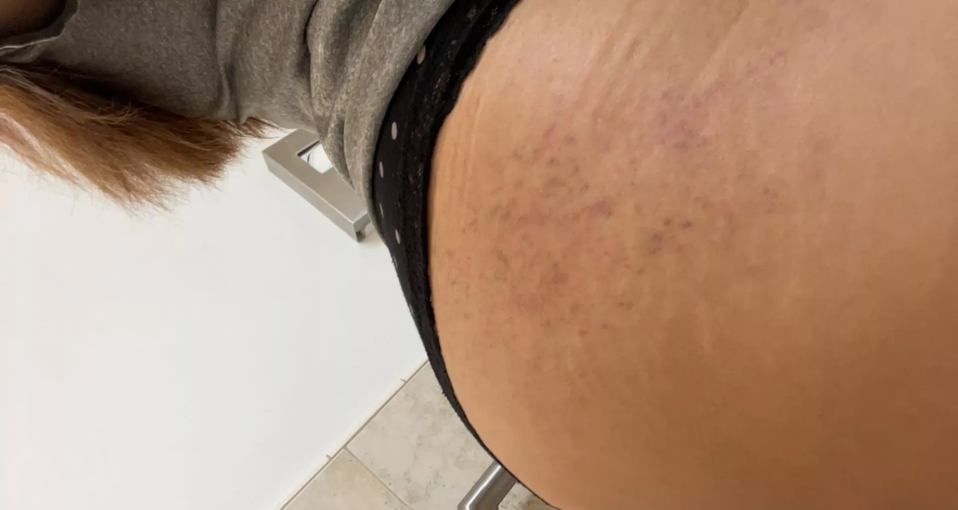 tinder hookup spanked me so much it left a mark …. i’d do let him do it again 😛🙈 posted by mislovelythang