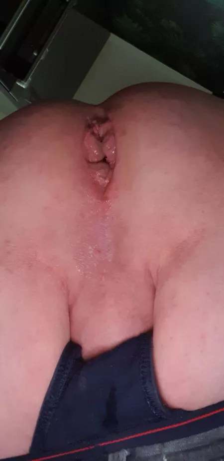 To big think I'm swollen by pegmemore