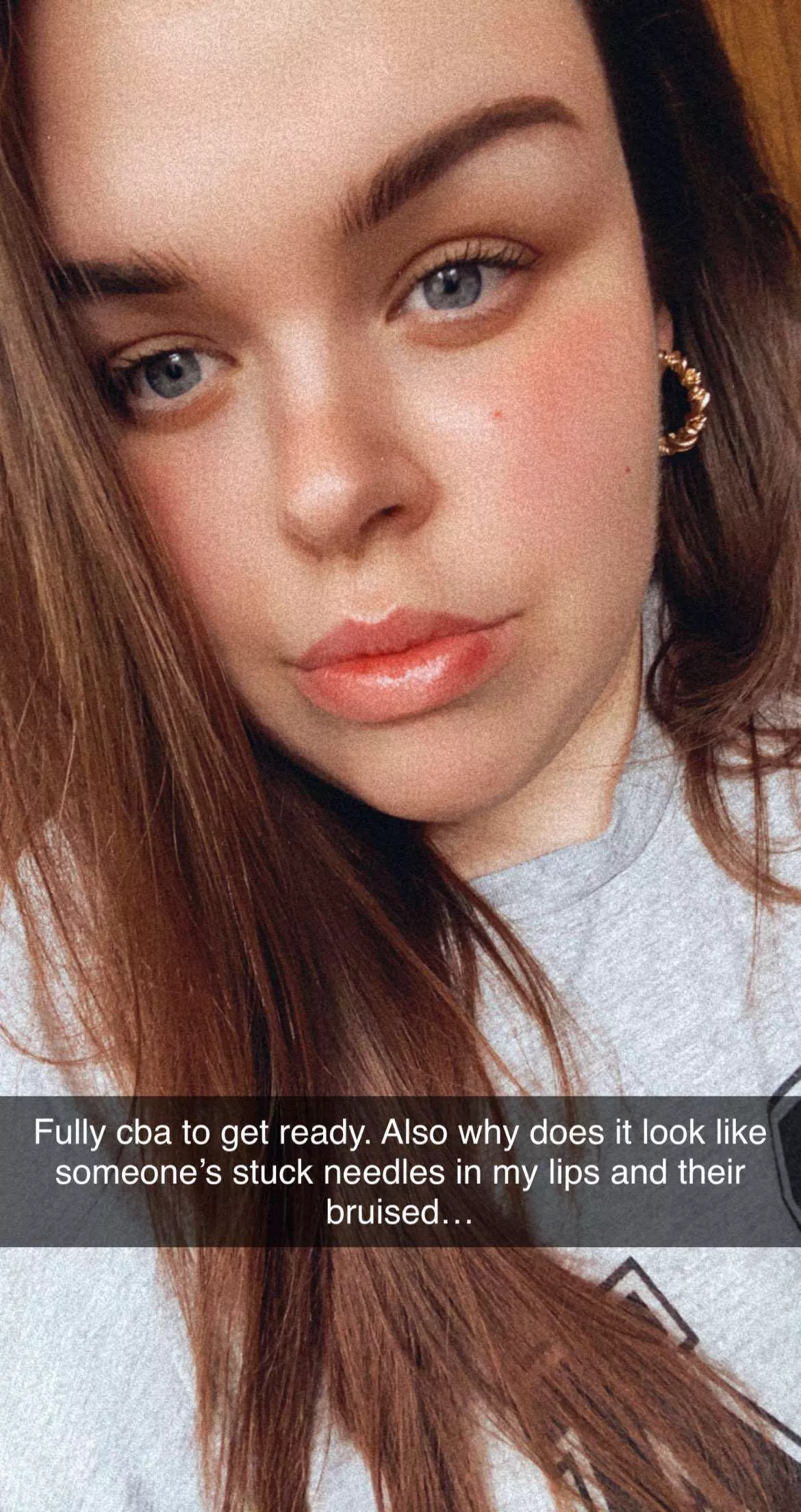 Today my DSL’s looked like I had fillers… no fillers here hunny. posted by Laujc