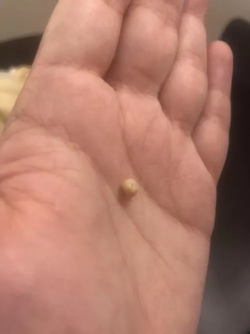 Toddler stuck his hand in my mouth and dislodged this guy 🤷🏻‍♀️ by Opposite_Ratio6545