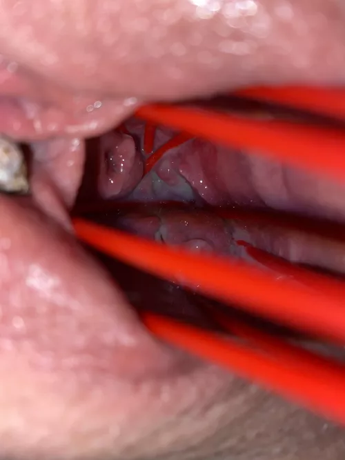 Tried a new kind of spreading… by dontask5678