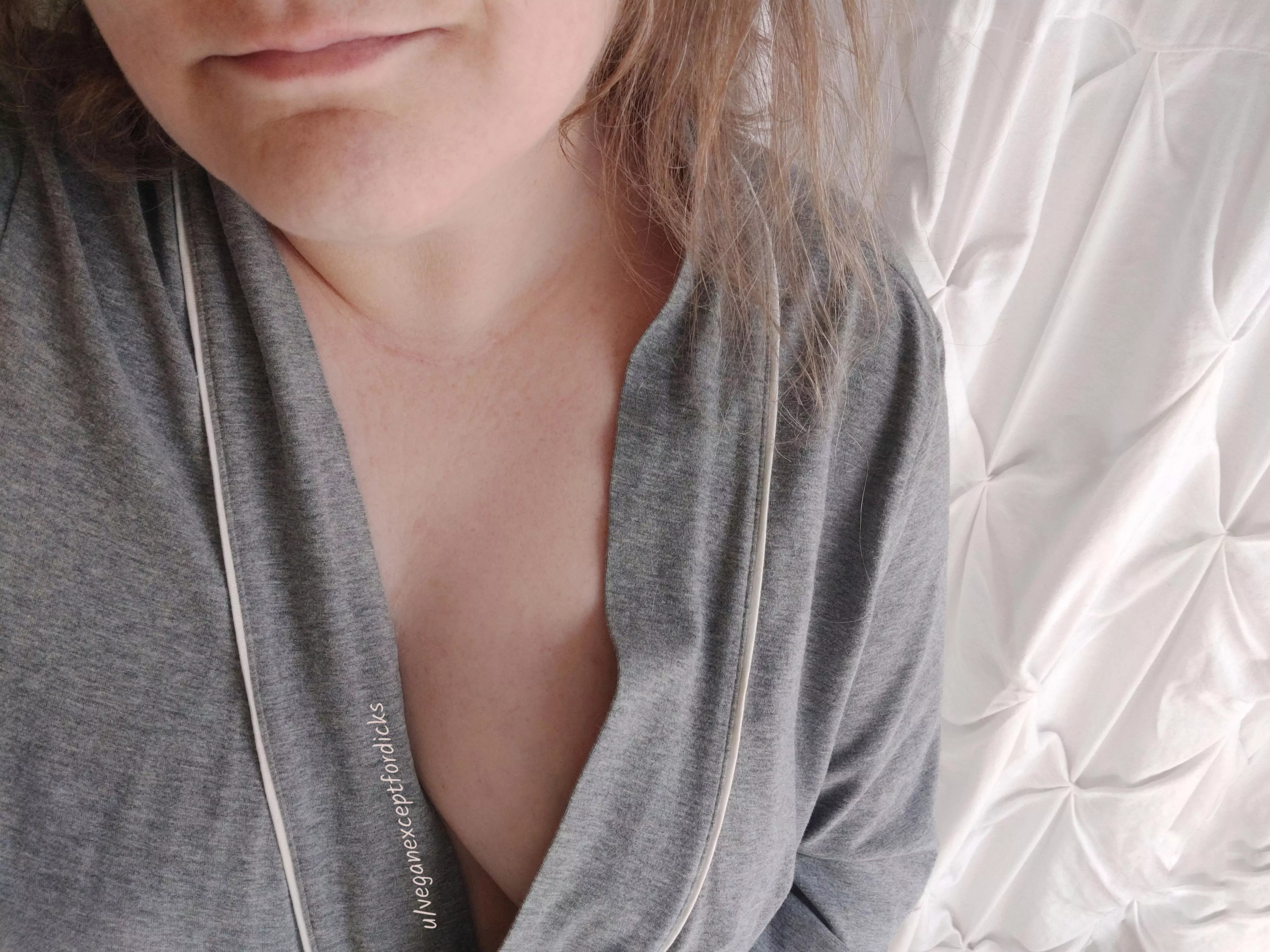 Up and at 'em posted by veganexceptfordicks