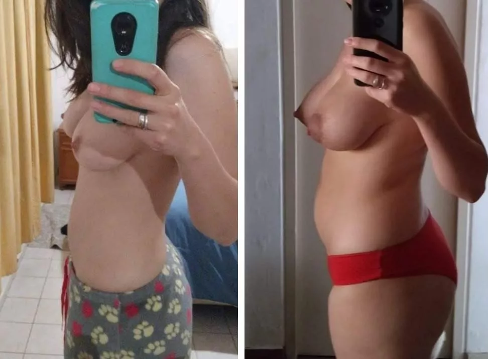 u/pareja-mendocina before and after pregnancy posted by Blankage1