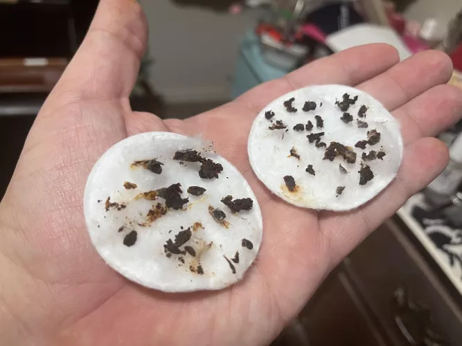 Used a camera assisted earwax tool for the first time ever. Now I can hear colors and smells. by DoctorBoombot