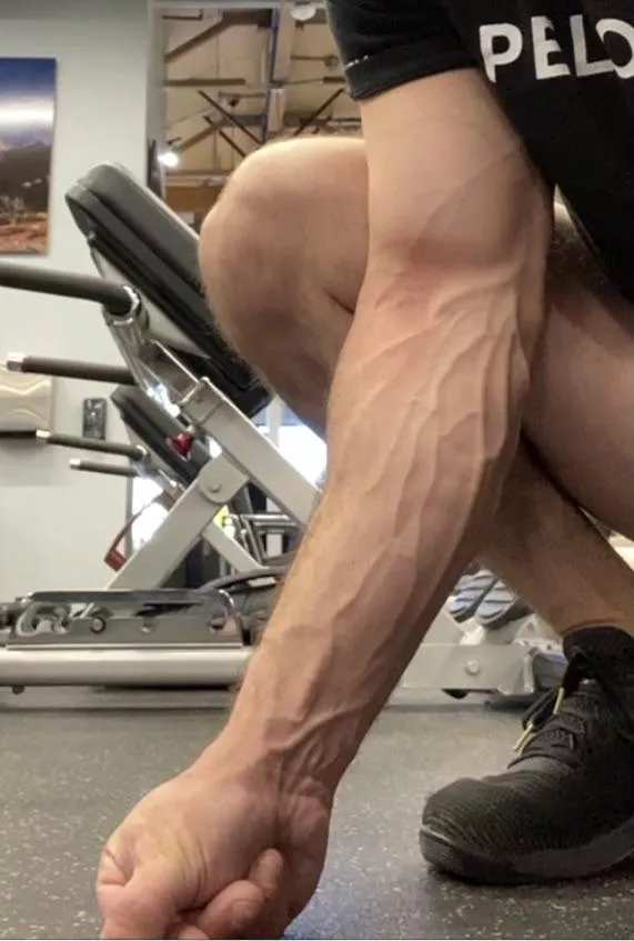 Vascular morning posted by nighthawk0505