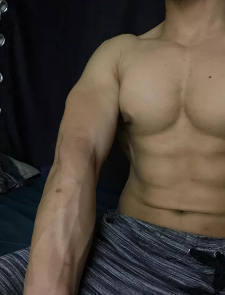 Veins but not much posted by gabrab24