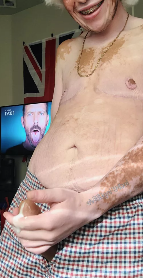 Vitiligo boi dripping by GabrielMadix