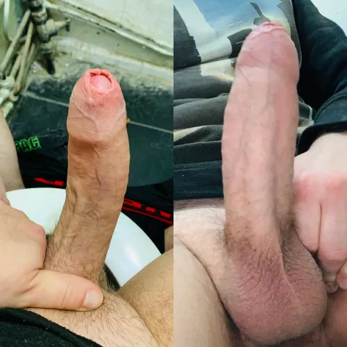 Wanna peel my hood back? by throwawaythedickpics