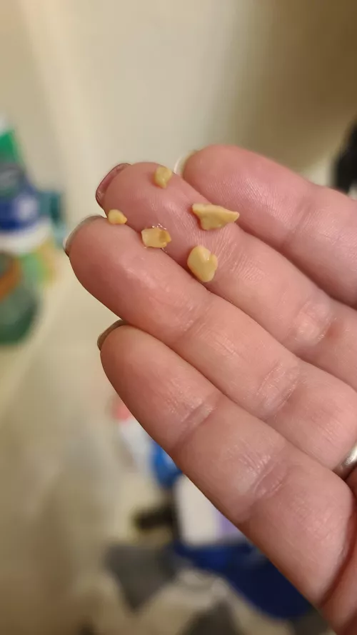 Was brushing my teeth today and sneezed these up this morning...then gaged from the smell and had to brush my teeth three times before I felt clean again. by Significant_Ad_6958