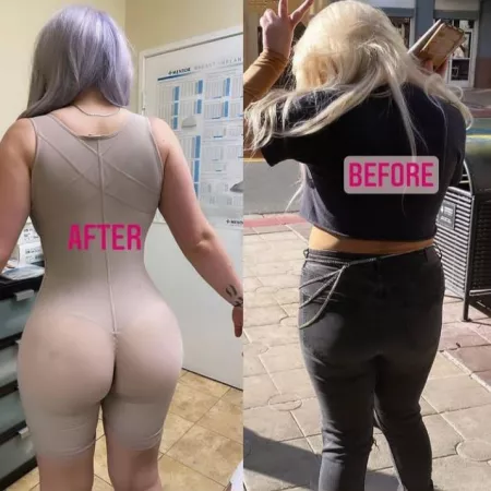 We reached 100k members on r/BoltedOnBooty! Thanks for your support and this a remainder that fake is better here by vocazados