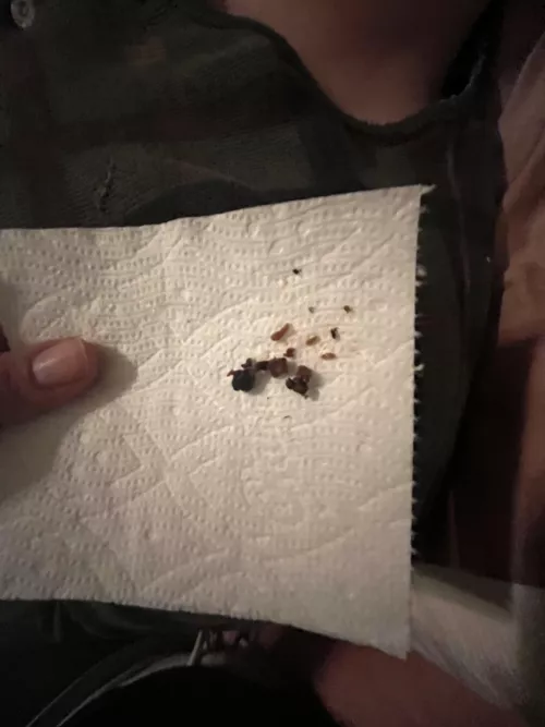 Went digging in my SO ear by overlynervous