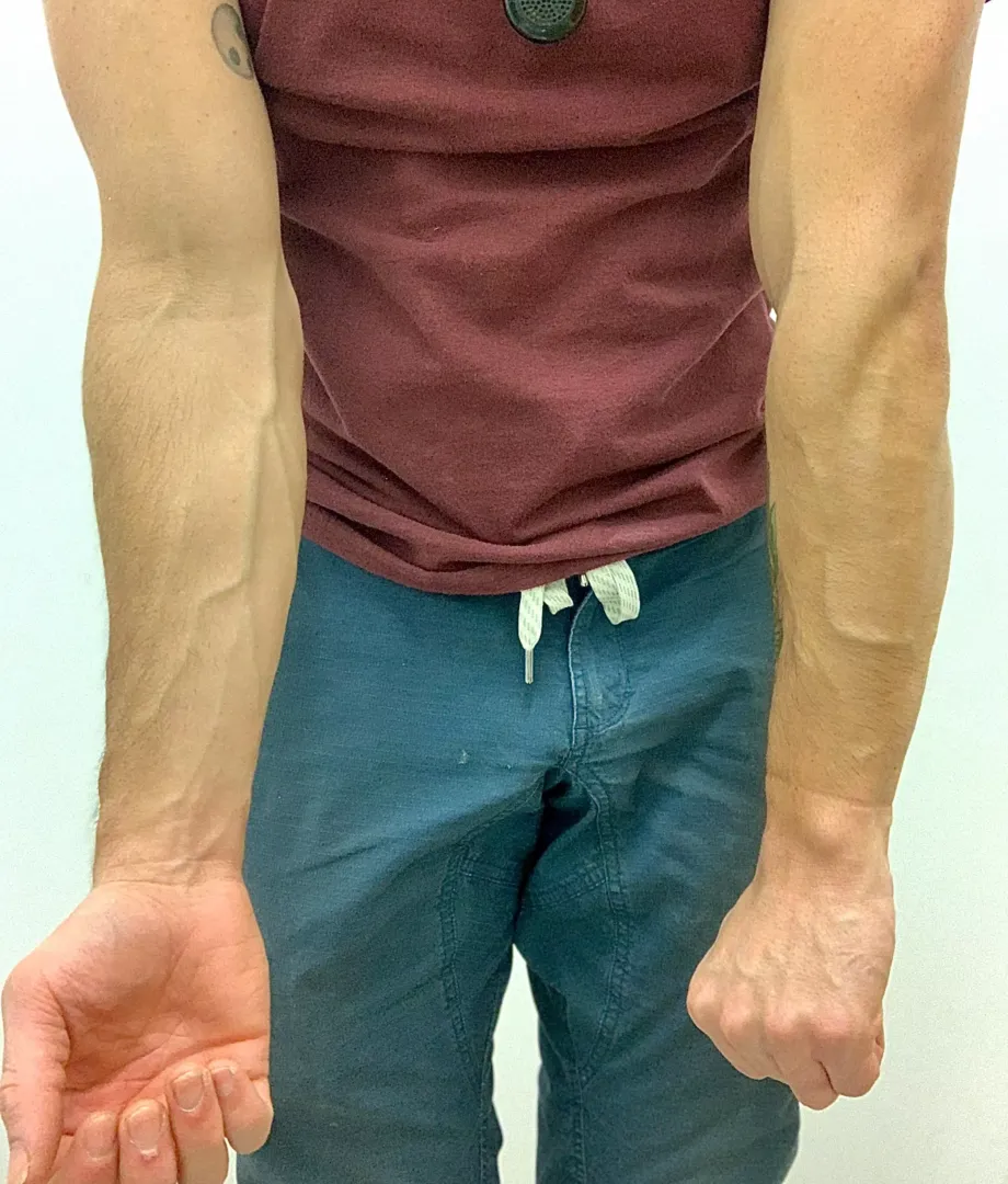 What do you think of my rock climber forearms? posted by Donut_dude0